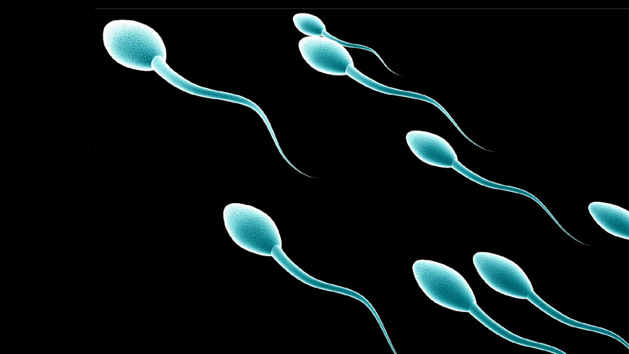 Low sperm count linked to health problems