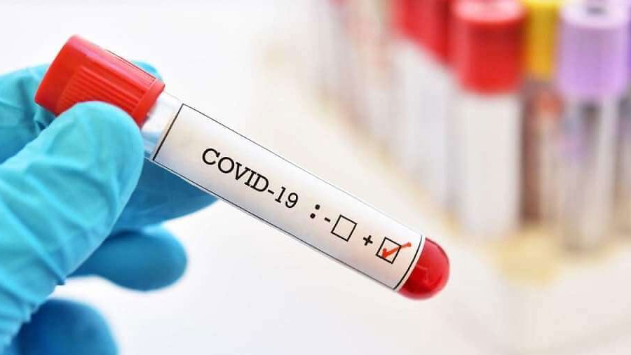 One in 10 worldwide may have had Covid, WHO says